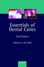 Cover: Essentials of Dental Caries - Oxford University Press