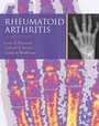 Cover: Rheumatoid Arthritis - Oxford University Press
