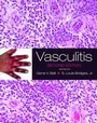 Cover: Vasculitis - Oxford University Press
