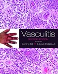 Cover: Vasculitis - Oxford University Press