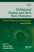 Cover: Abdominal Stomas and Their Skin Disorders - CRC Press