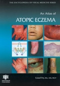 Cover: An Atlas of Atopic Eczema - CRC Press