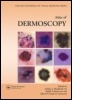 Cover: An Atlas of Dermoscopy - Informa Healthcare