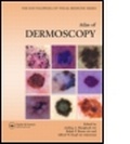 Cover: An Atlas of Dermoscopy - Informa Healthcare