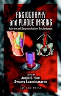 Cover: Angiography and Plaque Imaging - CRC Press