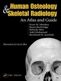 Abbildung von: Human Osteology and Skeletal Radiology - CRC Press