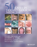 Cover: Fifty Dermatological Cases - CRC Press