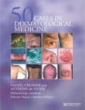 Cover: Fifty Dermatological Cases - CRC Press