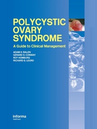 Bild vergrößern Bild: Polycystic Ovary Syndrome - CRC Press