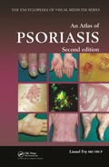 Cover: An Atlas of Psoriasis, Second Edition - CRC Press