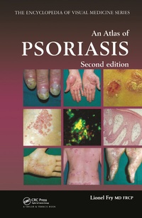 Enlarge image Cover: An Atlas of Psoriasis, Second Edition - CRC Press