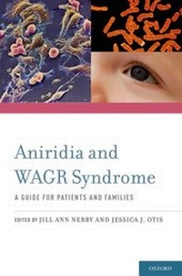 Abbildung von: Aniridia and WAGR Syndrome - Oxford University Press Inc