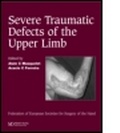 Cover: Severe Tramatic Defects of the Upper Limb - CRC Press
