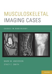 Enlarge image Cover: Musculoskeletal Imaging Cases - Oxford University Press Inc