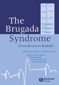 Cover: The Brugada Syndrome - Wiley