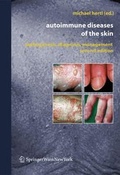 Cover: Autoimmune Diseases of the Skin - Springer