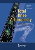 Cover: Total Knee Arthroplasty - Springer