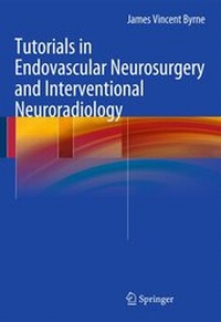 Abbildung von: Tutorials in Endovascular Neurosurgery and Interventional Neuroradiology - Springer