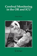Abbildung von: Cerebral Monitoring in the OR and ICU - Springer