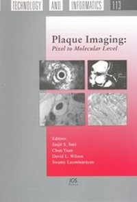 Enlarge image Cover: Plaque Imaging: Pixel to Molecular Level - IOS Press,US