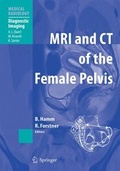 Cover: MRI and CT of the Female Pelvis - Springer