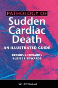 Cover: Pathology of Sudden Cardiac Death - Wiley