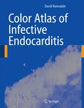 Bild: Color Atlas of Infective Endocarditis - Springer