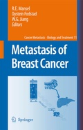 Cover: Metastasis of Breast Cancer - Springer