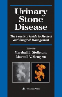 Abbildung von: Urinary Stone Disease - Humana Press Inc.