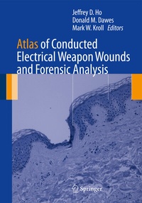 Abbildung von: Atlas of Conducted Electrical Weapon Wounds and Forensic Analysis - Springer