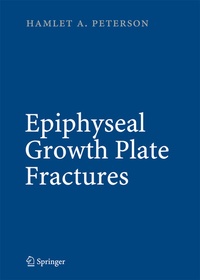 Abbildung von: Epiphyseal Growth Plate Fractures - Springer