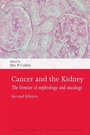 Cover: Cancer and the Kidney - Oxford University Press