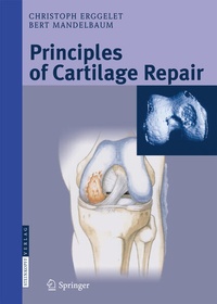 Abbildung von: Principles of Cartilage Repair - Steinkopff