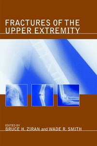 Enlarge image Cover: Fractures of the Upper Extremity - CRC Press