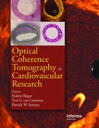 Abbildung von: Optical Coherence Tomography in Cardiovascular Research - CRC Press