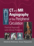 Cover: CT and MR Angiography of the Peripheral Circulation - CRC Press