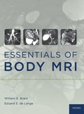 Cover: Essentials of Body MRI - Oxford University Press Inc