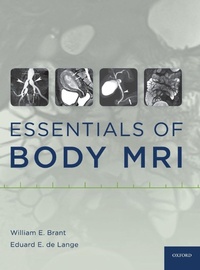Enlarge image Cover: Essentials of Body MRI - Oxford University Press Inc