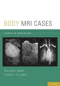 Enlarge image Cover: Body MRI Cases - Oxford University Press Inc