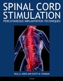 Cover: Spinal Cord Stimulation - OUP eBook