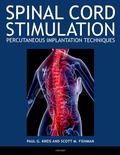 Cover: Spinal Cord Stimulation - OUP eBook