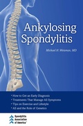 Cover: Ankylosing Spondylitis - OUP eBook