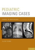 Cover: Pediatric Imaging Cases - Oxford University Press Inc