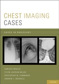 Cover: Chest Imaging Cases - OUP eBook