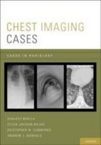 Bild vergrößern Bild: Chest Imaging Cases - OUP eBook