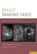 Cover: Breast Imaging Cases - OUP eBook