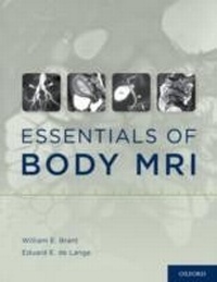 Abbildung von: Essentials of Body MRI - OUP eBook
