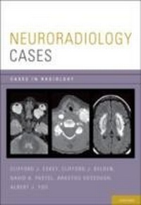Bild: Neuroradiology Cases - OUP eBook
