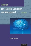 Cover: Atlas of EEG, Seizure Semiology, and Management - Oxford University Press Inc