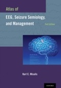 Bild: Atlas of EEG, Seizure Semiology, and Management - OUP eBook